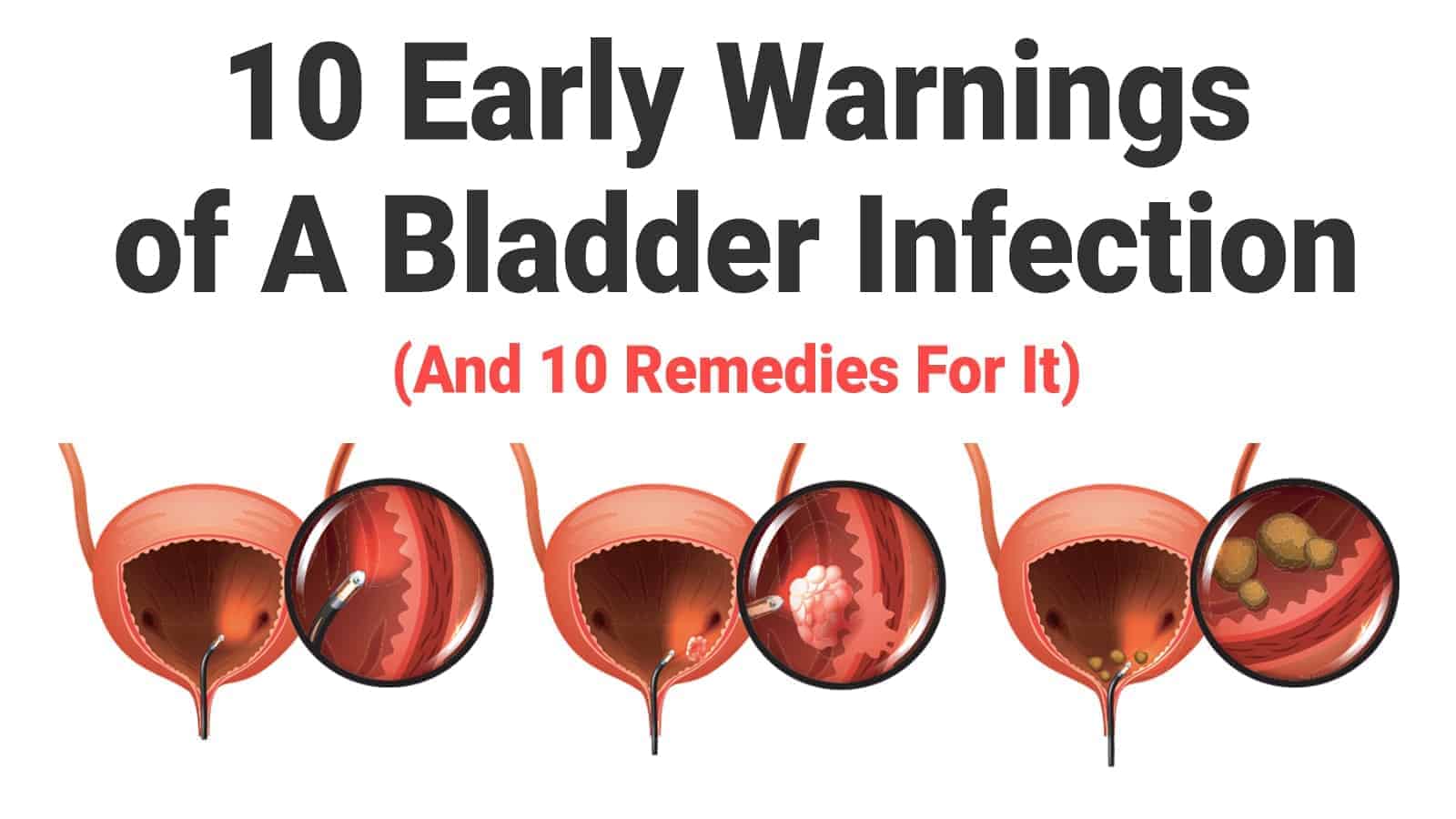 10 Early Warnings of A Bladder Infection (And 10 Remedies For It)