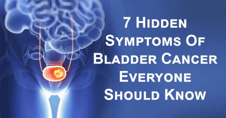 7 Hidden Symptoms Of Bladder Cancer Everyone Should Know ...