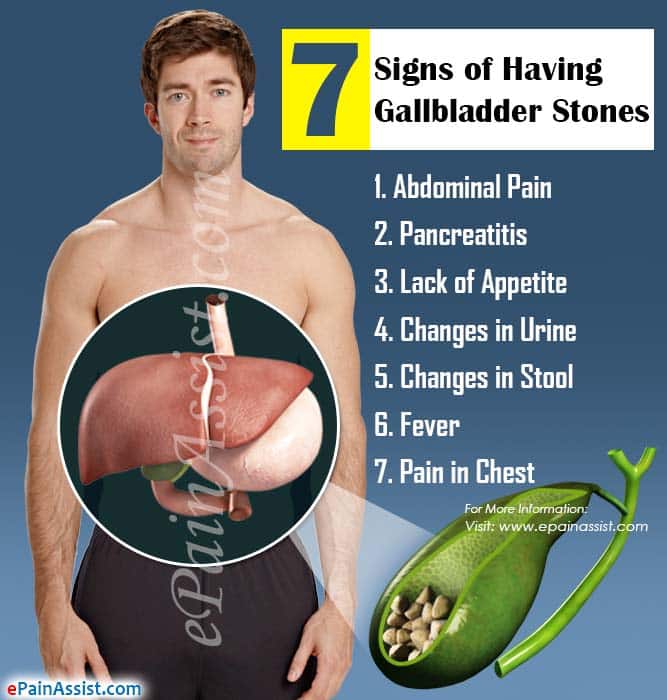 7 Signs of Having Gallbladder Stones