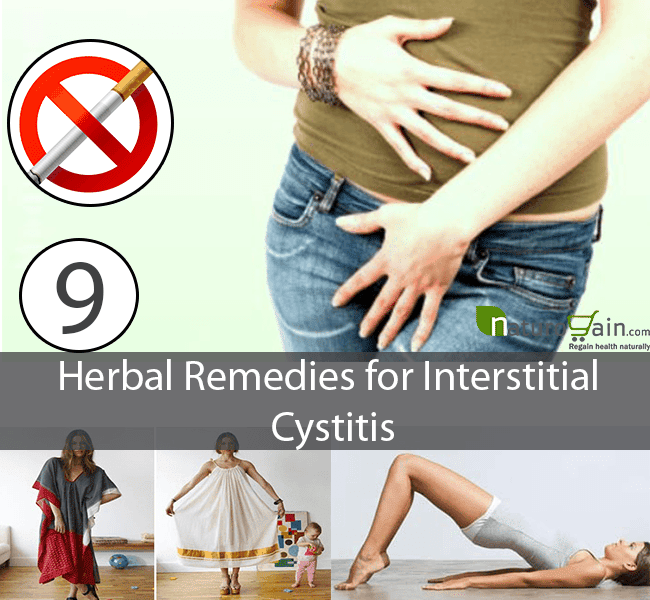 9 Herbal Remedies for Interstitial Cystitis