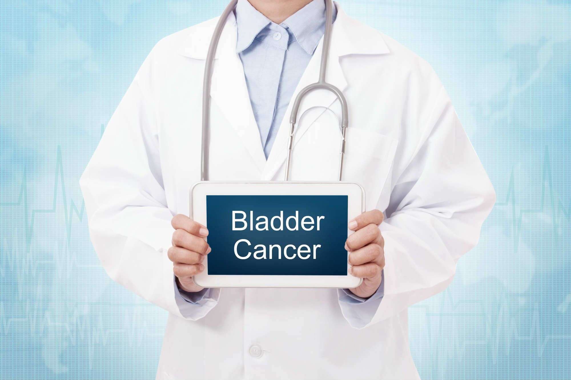 Actos and Bladder Cancer Lawsuit Blames Illness on Lack of ...
