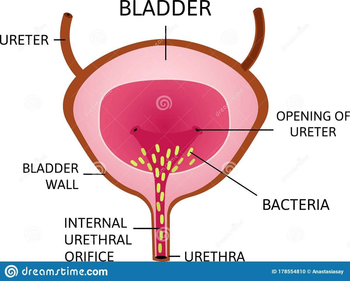 Bacteria In Urinary Bladder Or Simply Bladder. Green Small Cell Which ...