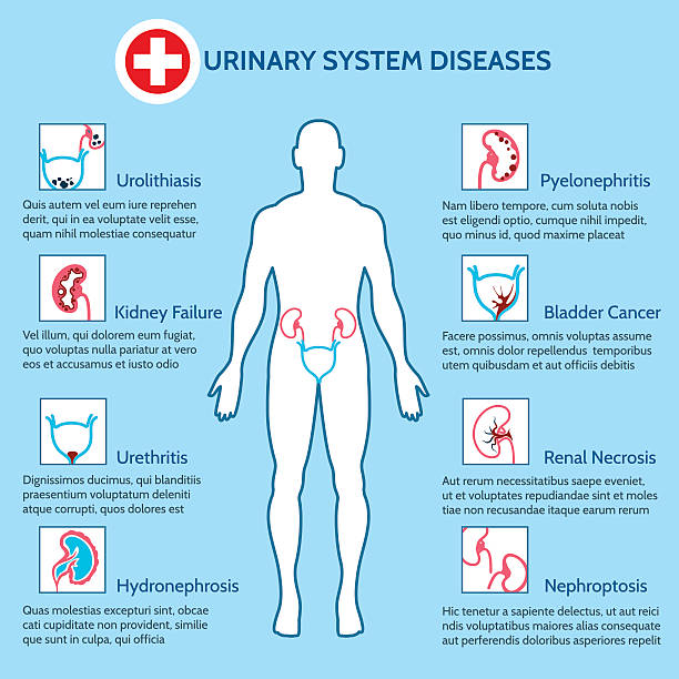 Best Urinary Tract Infection Illustrations, Royalty
