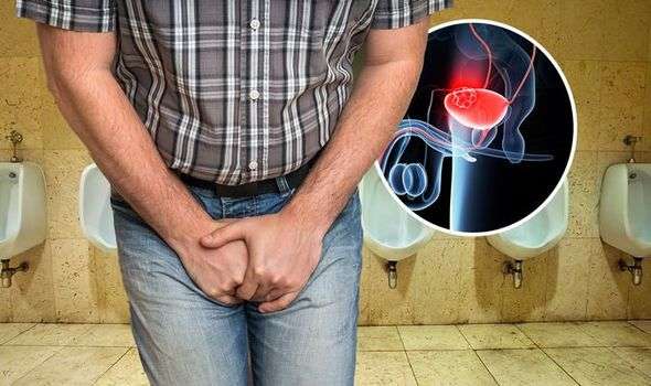 Bladder cancer symptoms: If your urine turns this colour ...