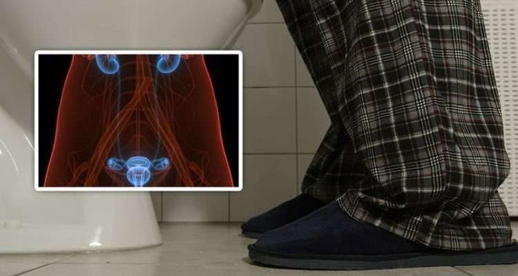 Bladder cancer symptoms: The colour of your urine could pinpoint the ...