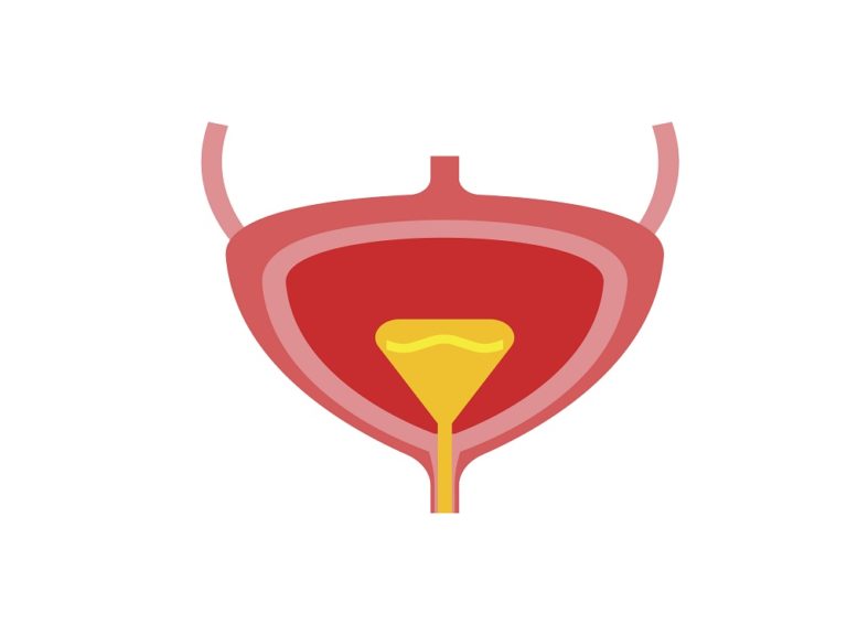 Bladder Hydrodistention May Ease Nocturia in Interstitial Cystitis ...