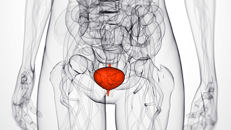 Bladder Side Effects of Cancer Treatment