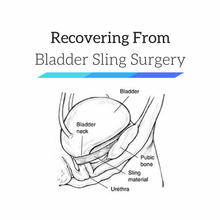Bladder Sling Surgery Recovery After TOT, TVT, Bone