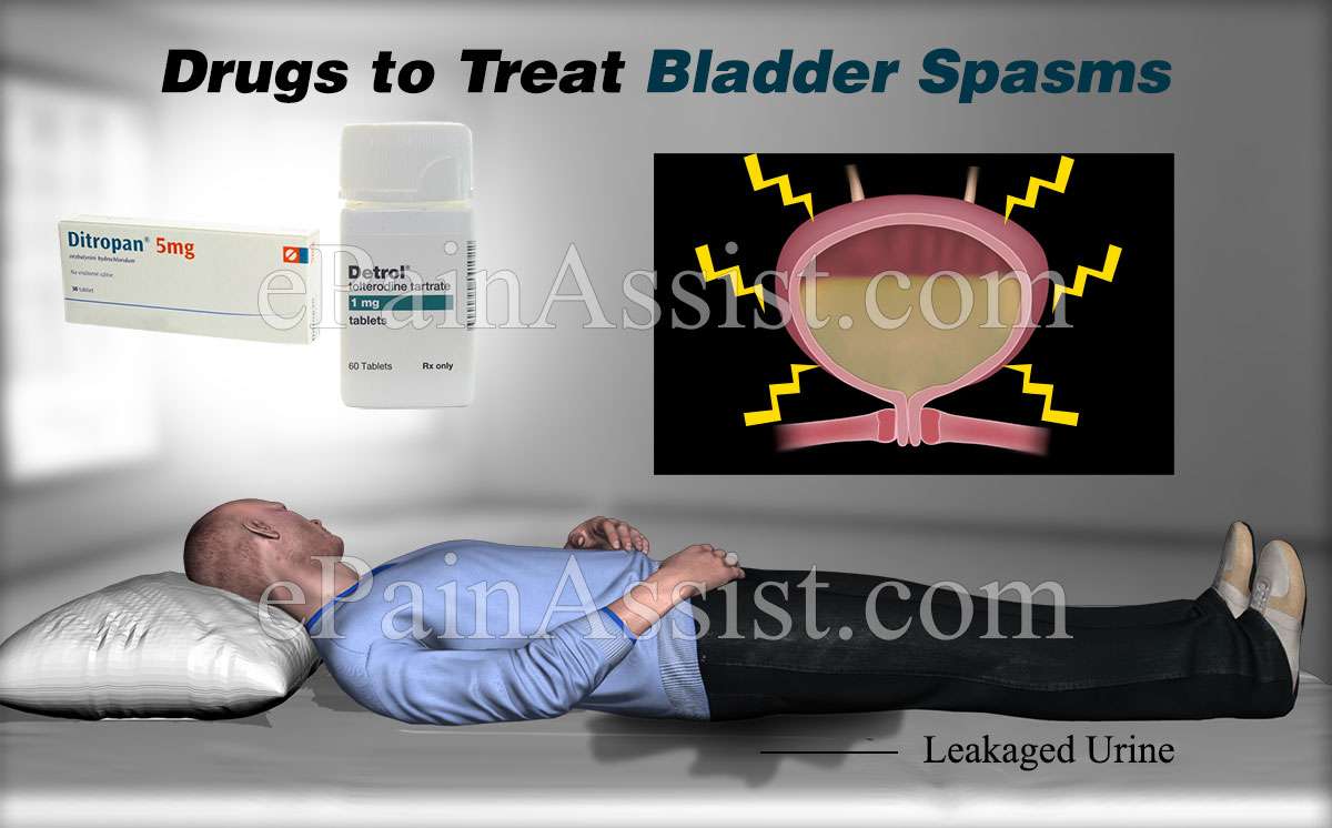 Bladder Spasms Treatment
