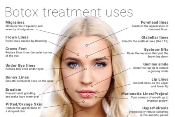 Botox Injection As Cosmetic procedure Side effects &  Benefits