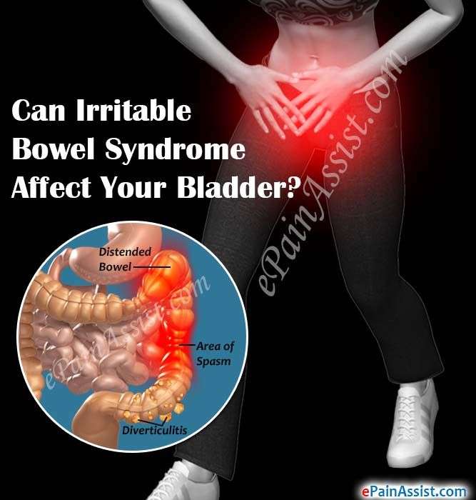 Can Irritable Bowel Syndrome Affect Your Bladder?