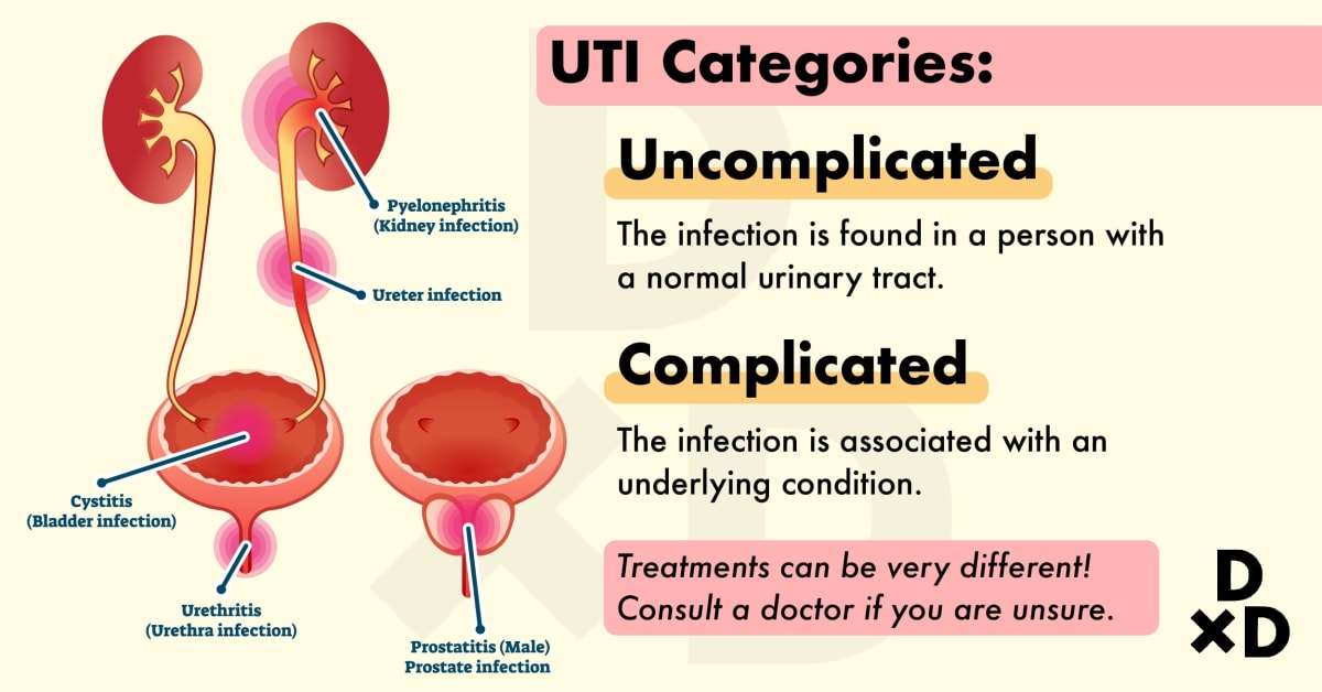 Can You Have A uti Without fever or Pain