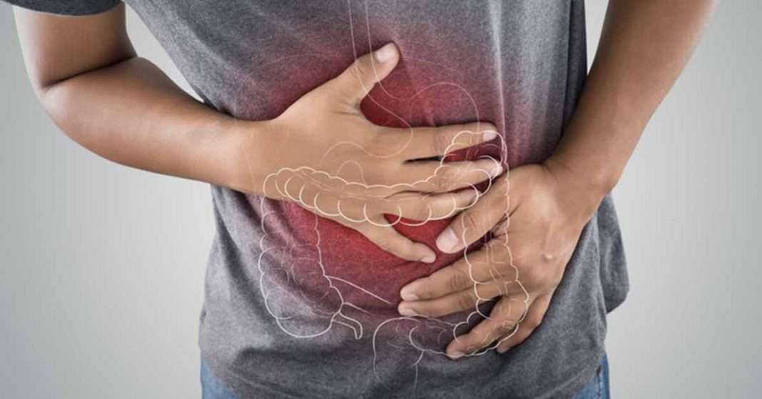 Cause of Irritable Bowel Syndrome Found, Disease on a Spectrum with ...