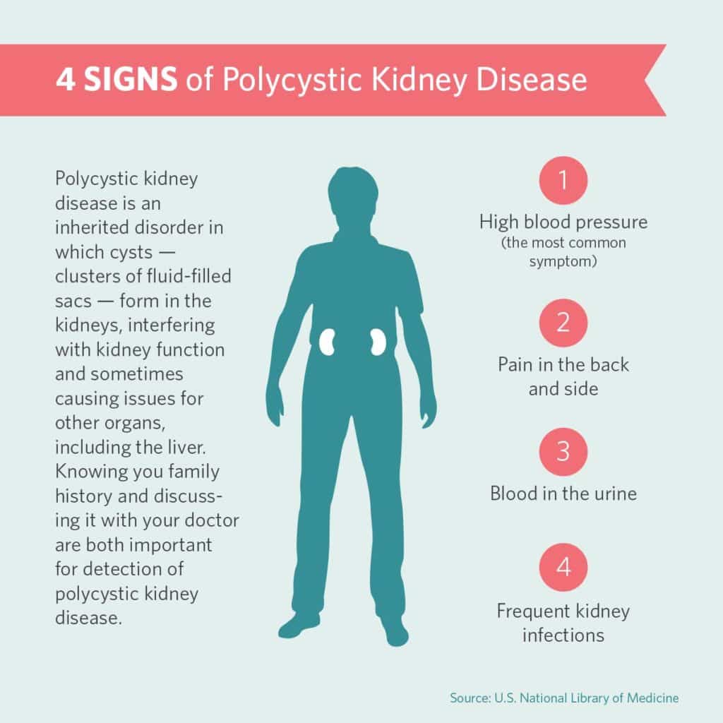 CBD for Polycystic Kidney Disease