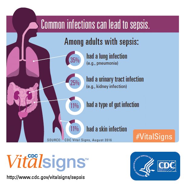 CDC on Twitter: " T5 Sepsis is most often associated with 1 in 4 types ...