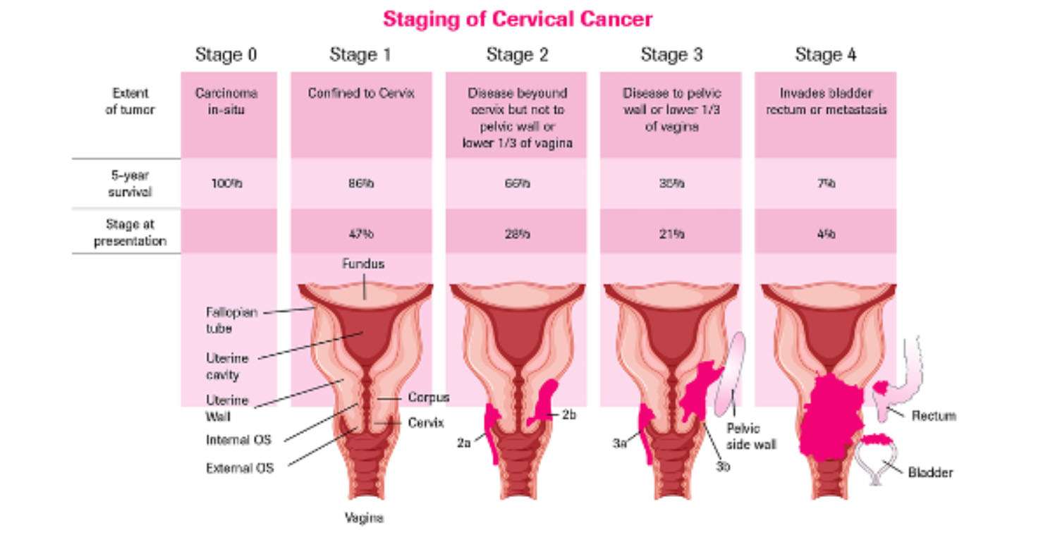 Cervical Carcinoma Booklet