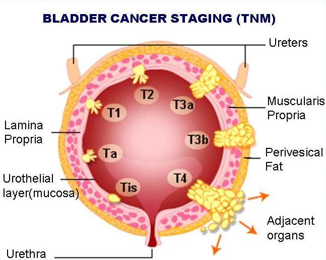 Cortex moutan induces bladder cancer cell death via ...