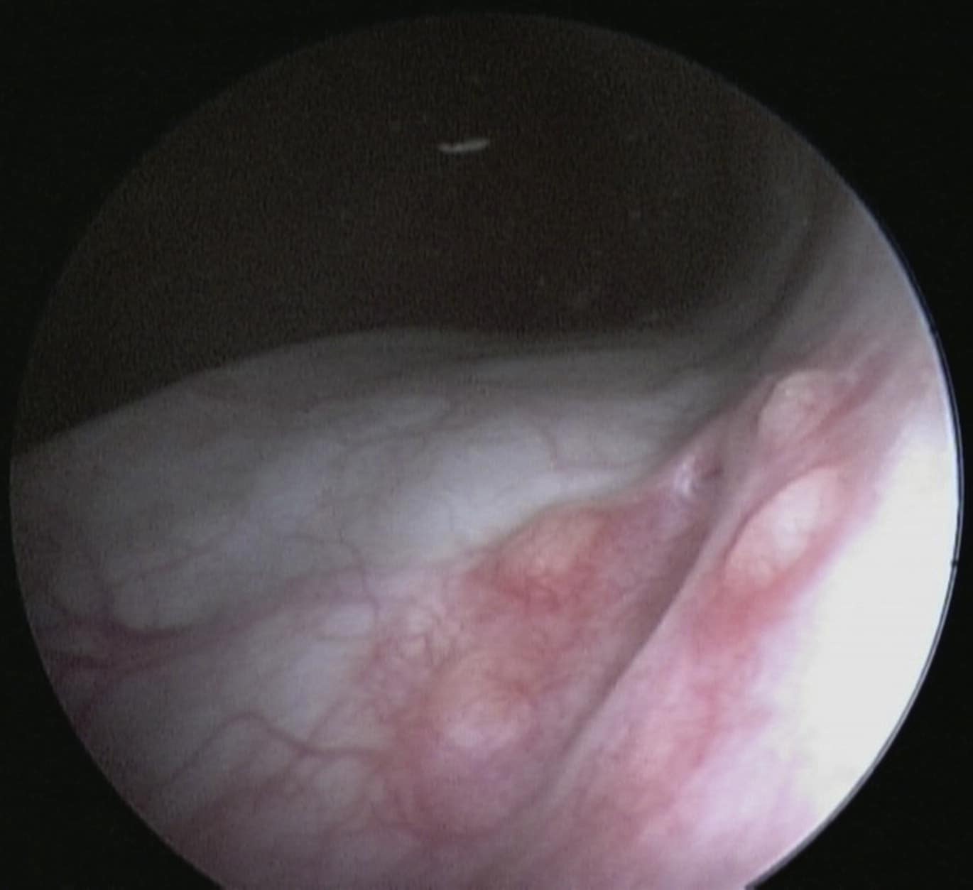 Cystoscopy in Dogs and Cats
