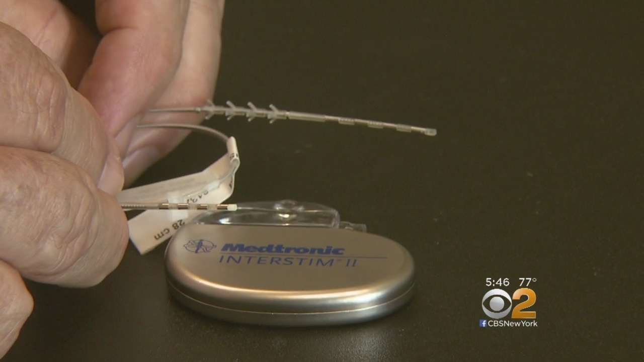 Doctors Use Pacemaker