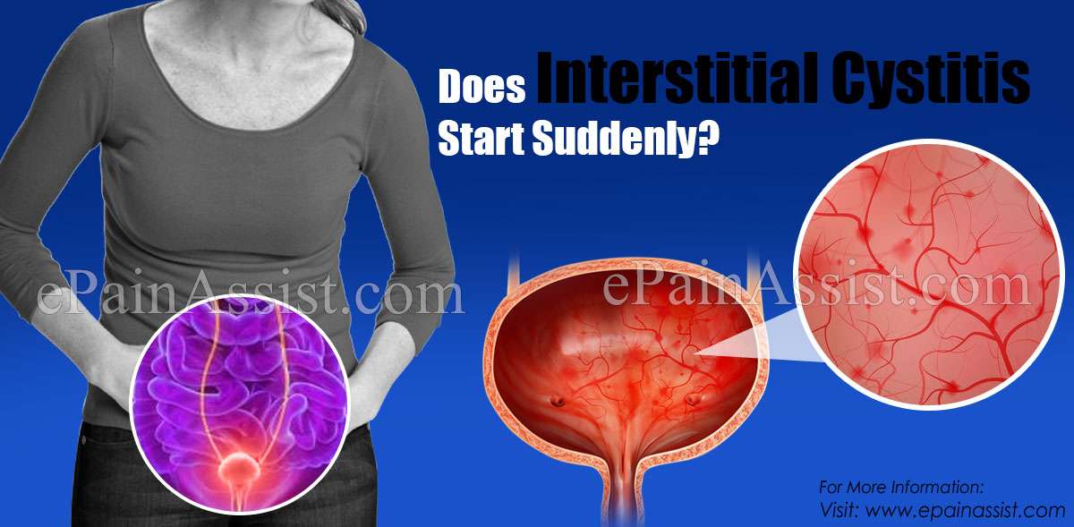 Does Interstitial Cystitis Start Suddenly &  Can It Be Sexually Transmitted?