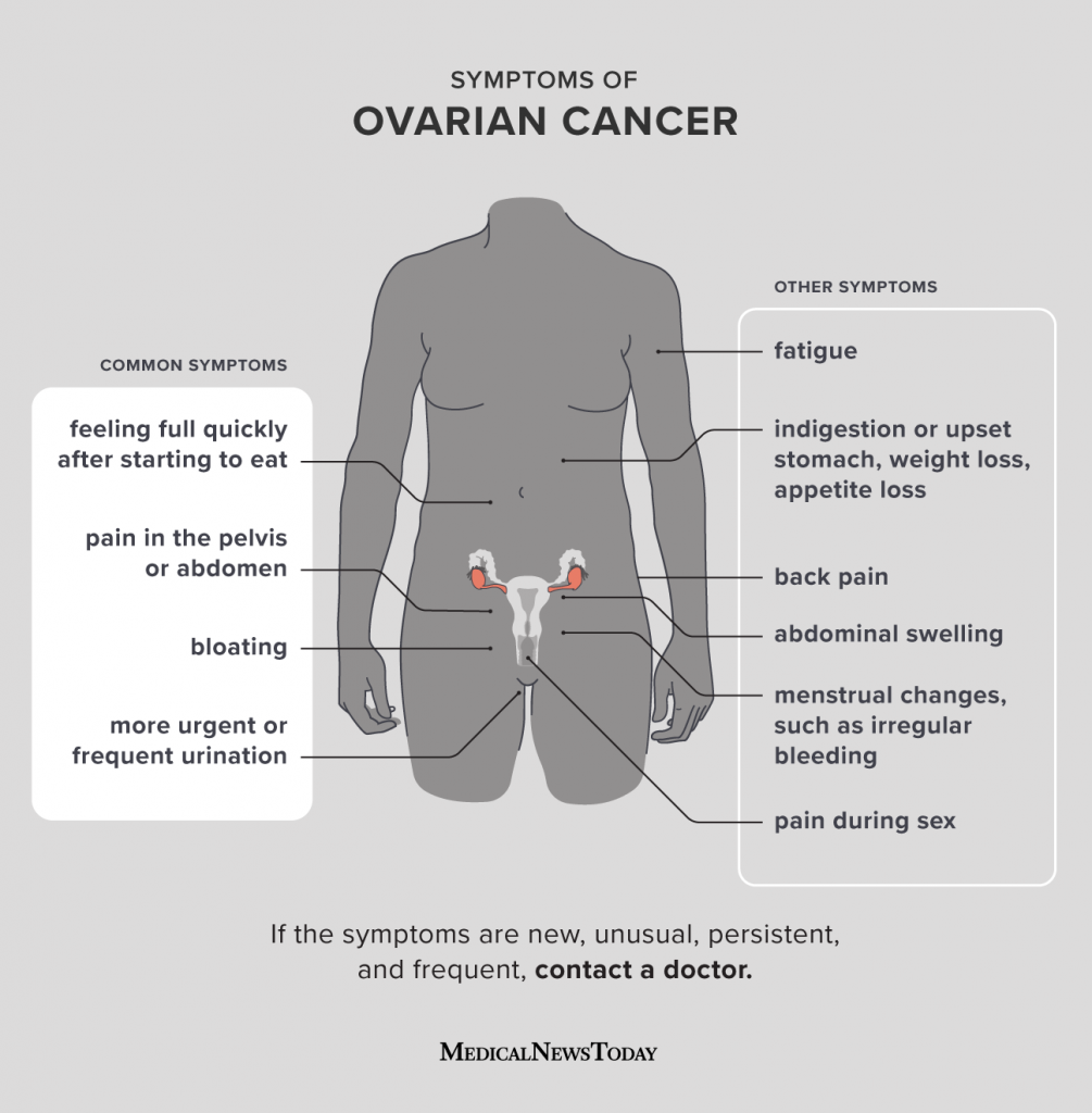 Early symptoms of ovarian cancer: What does it feel like?