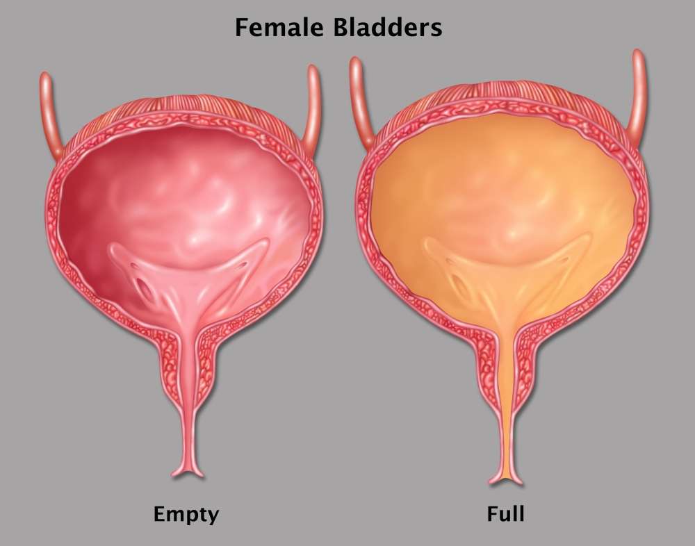Empty and Full Female Bladder Illustration Stretched Canvas