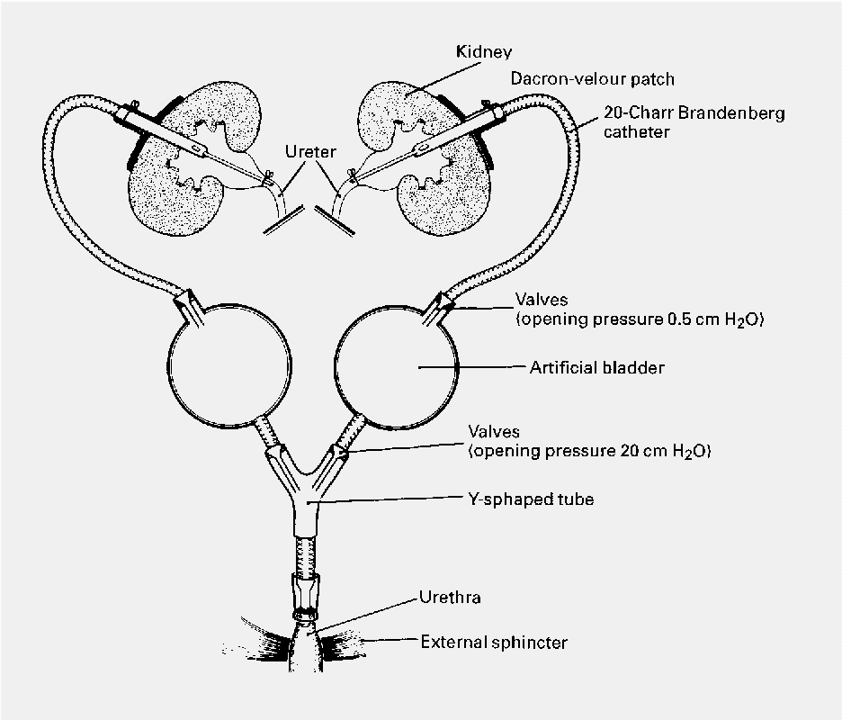 Figure 2 from The Artificial Bladder