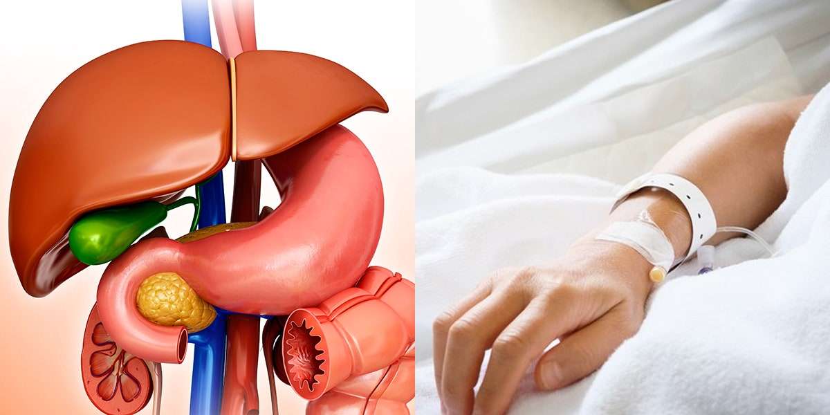 Gallbladder Removal: Heres What to Expect Before, During, and After