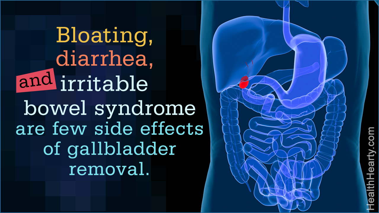 Gallbladder Removal Side Effects