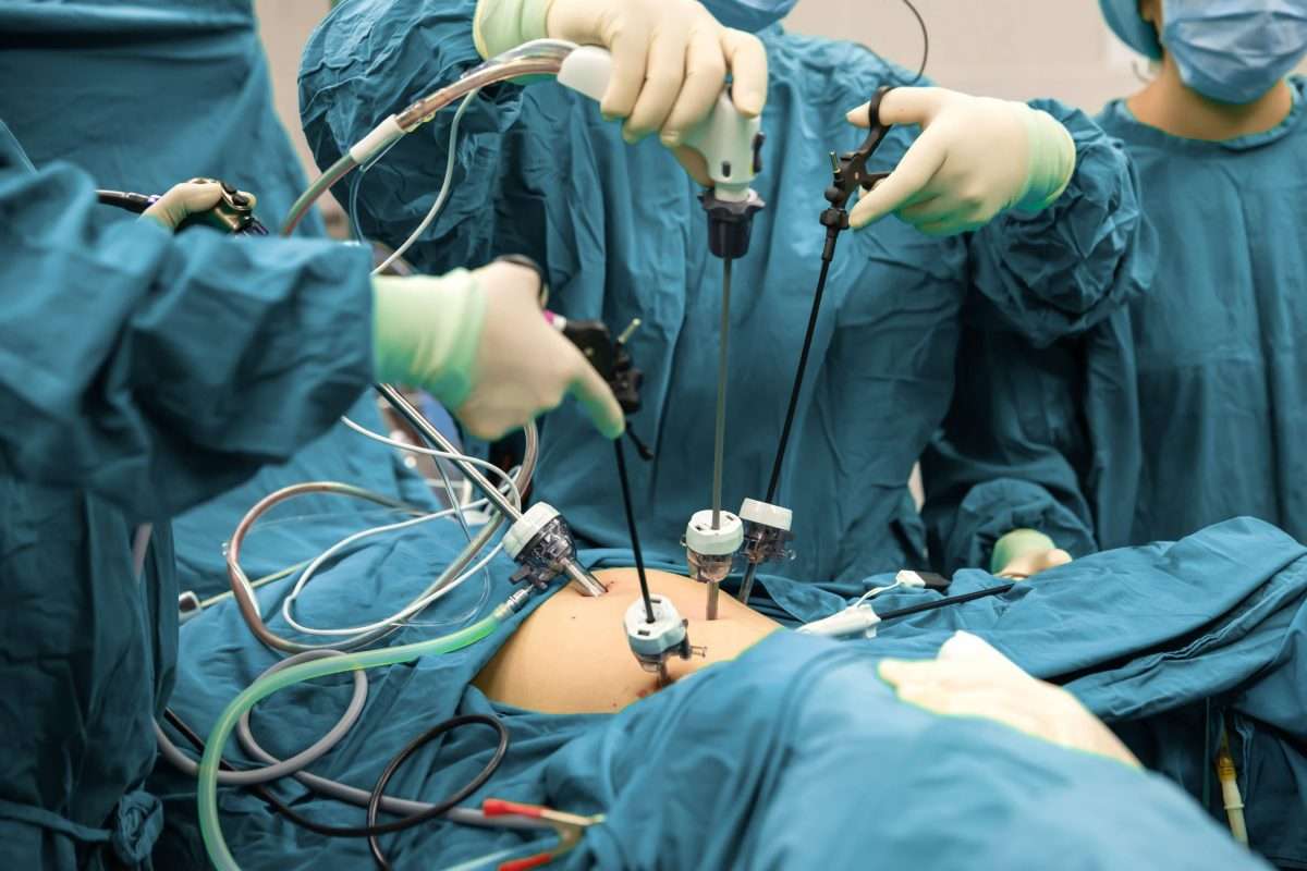 Gallbladder Surgery: What to Expect on the Day of Surgery