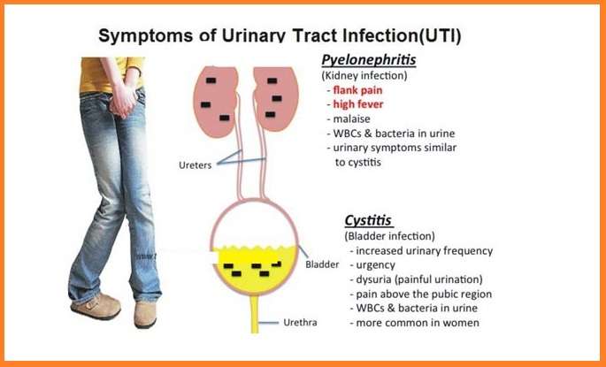 Home remedies for uti and treatment without antibiotics Naturally