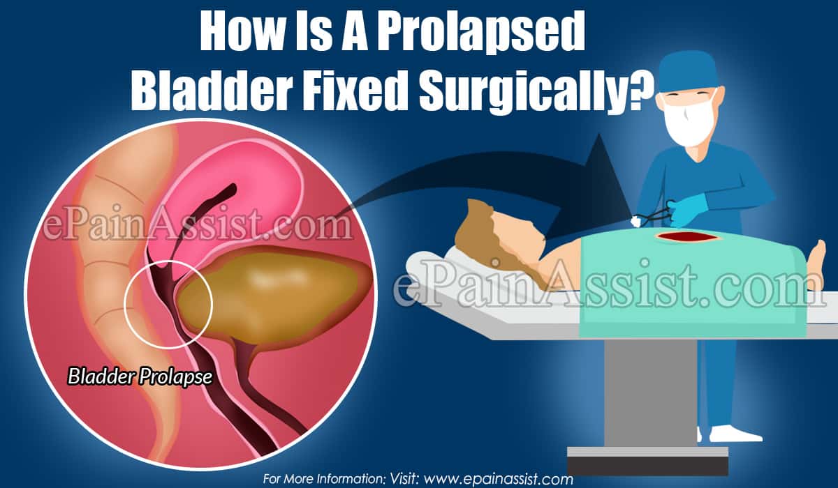 How Is A Prolapsed Bladder Fixed Surgically?
