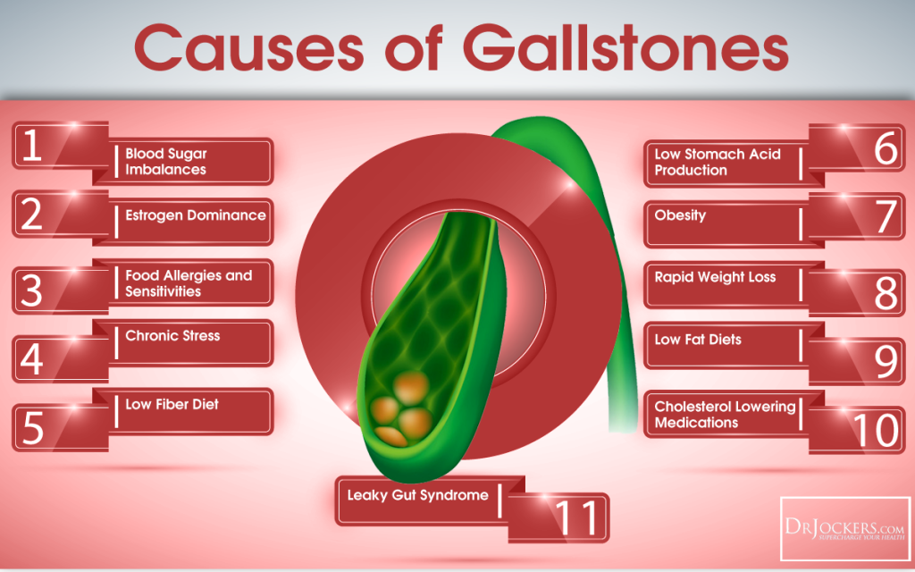 How to Beat GallStones Naturally