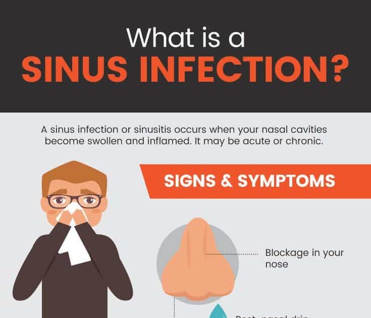How To Clear Up Sinus Infection Without Antibiotics