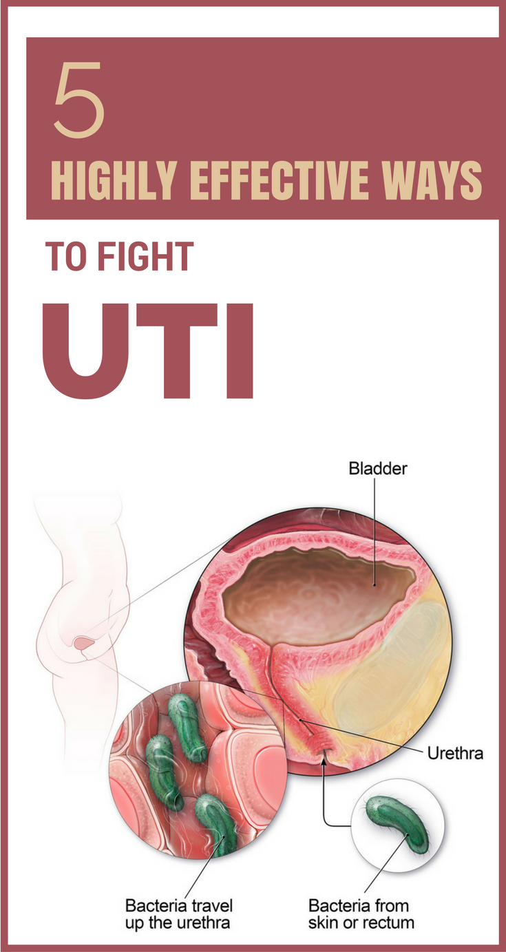 How To Get Rid Of Uncomfortable Uti Feeling