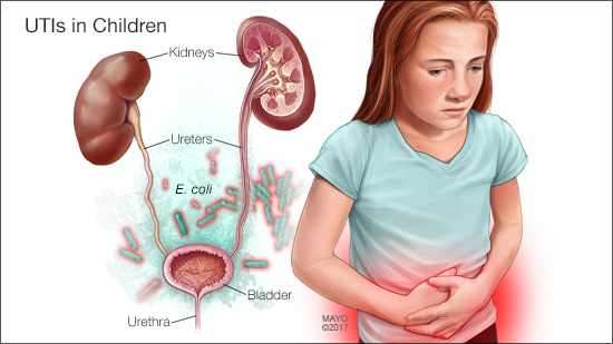 How to Spot Series: Urinary Tract Infection in Children