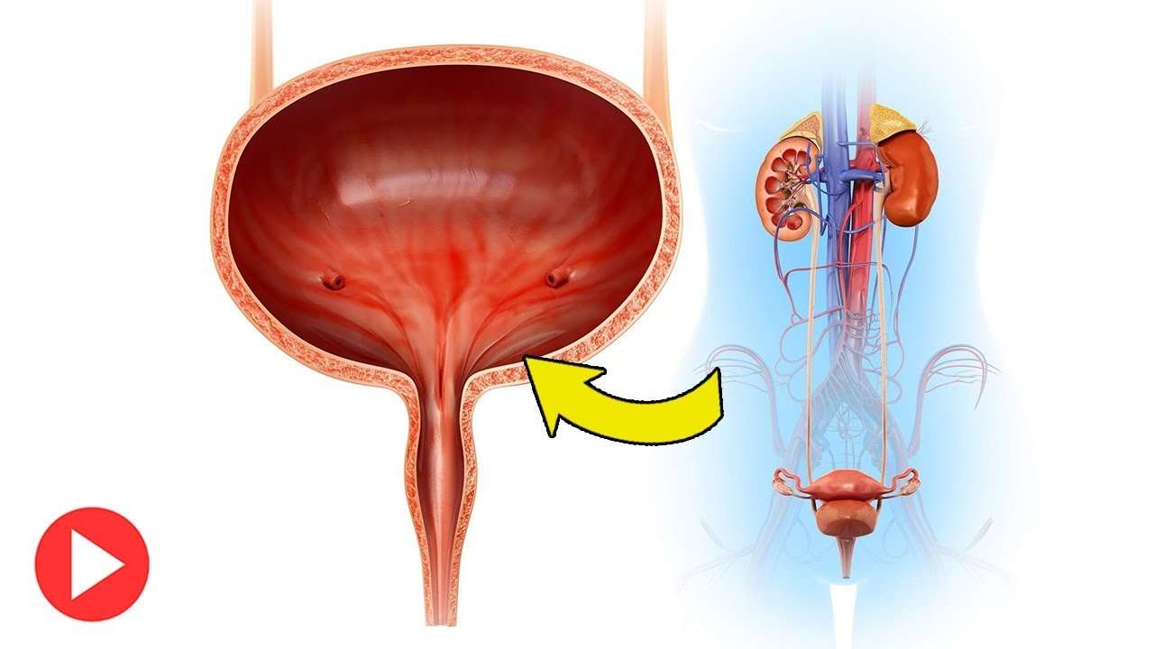 How To Treat Overactive Bladder Naturally: 10 Natural Tips ...
