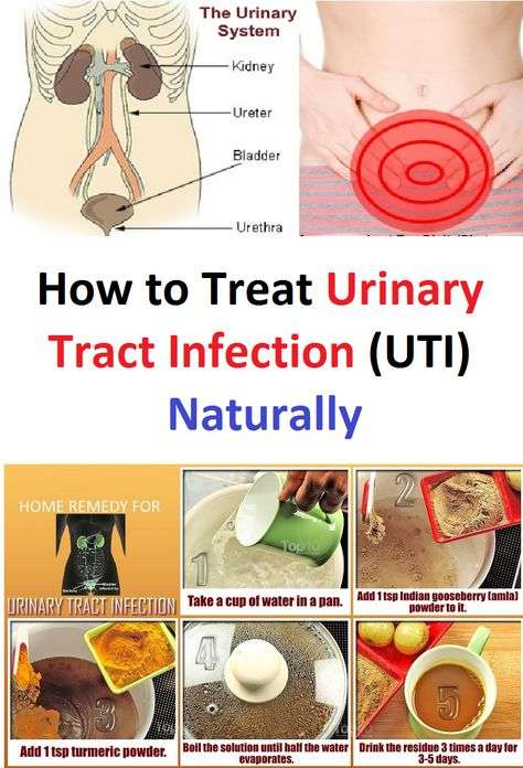 How to Treat Urinary Tract Infection (UTI) Naturally (With images ...