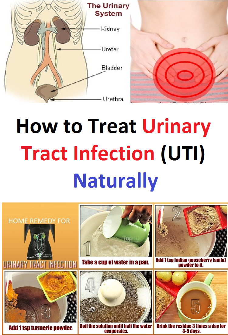 How to Treat Urinary Tract Infection (UTI) Naturally ...