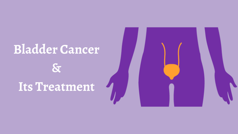 Ikris Pharma Blog: Bladder Cancer And Its Treatment