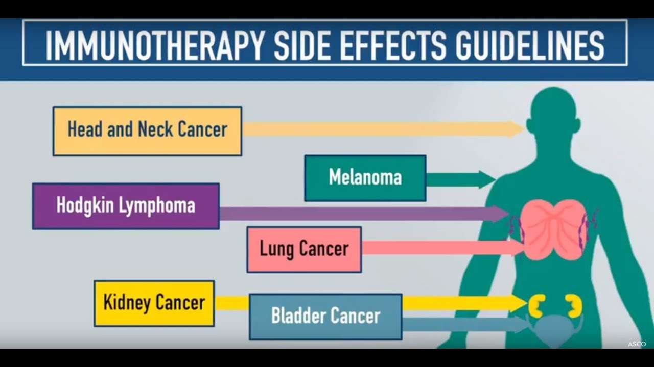 Immunotherapy Side Effects Guidelines