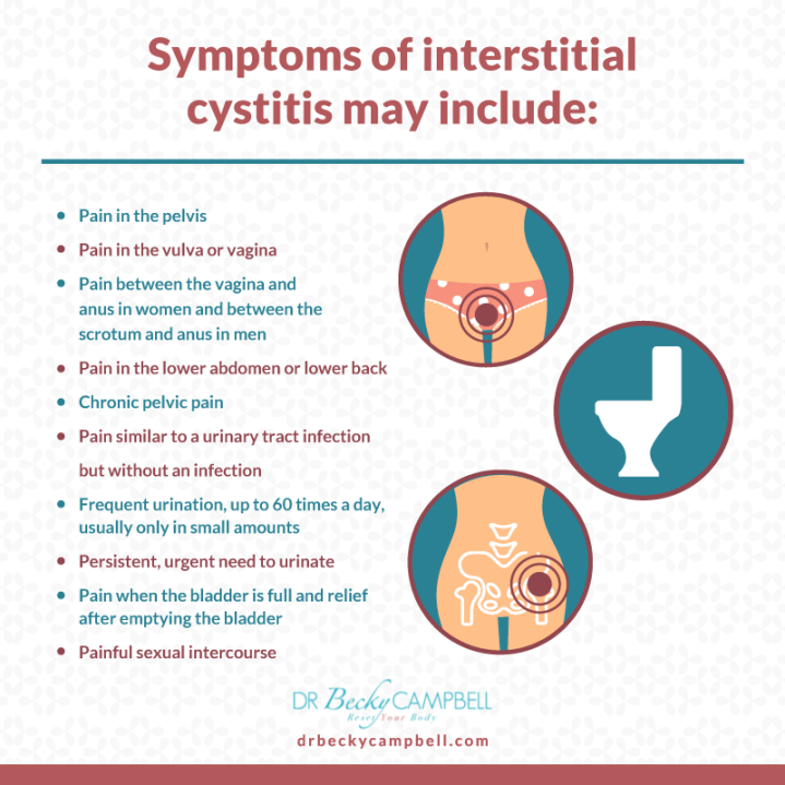 Interstitial Cystitis and the Histamine Connection