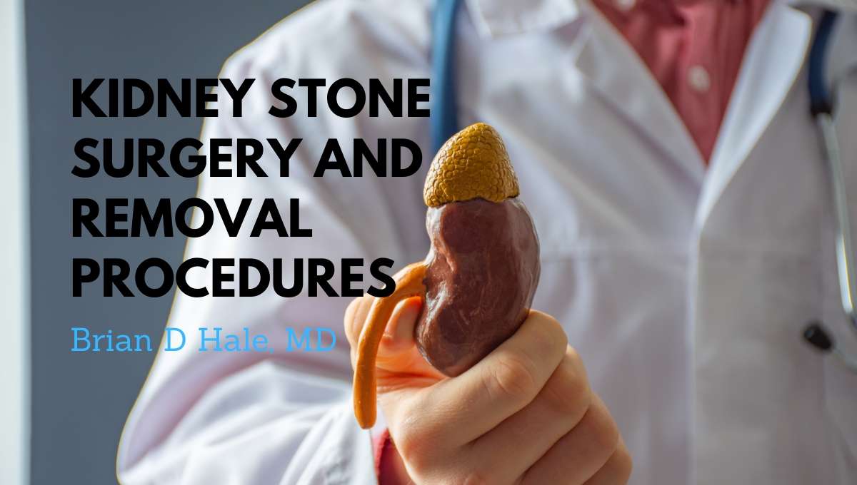 Kidney Stone Surgery and Removal Procedures