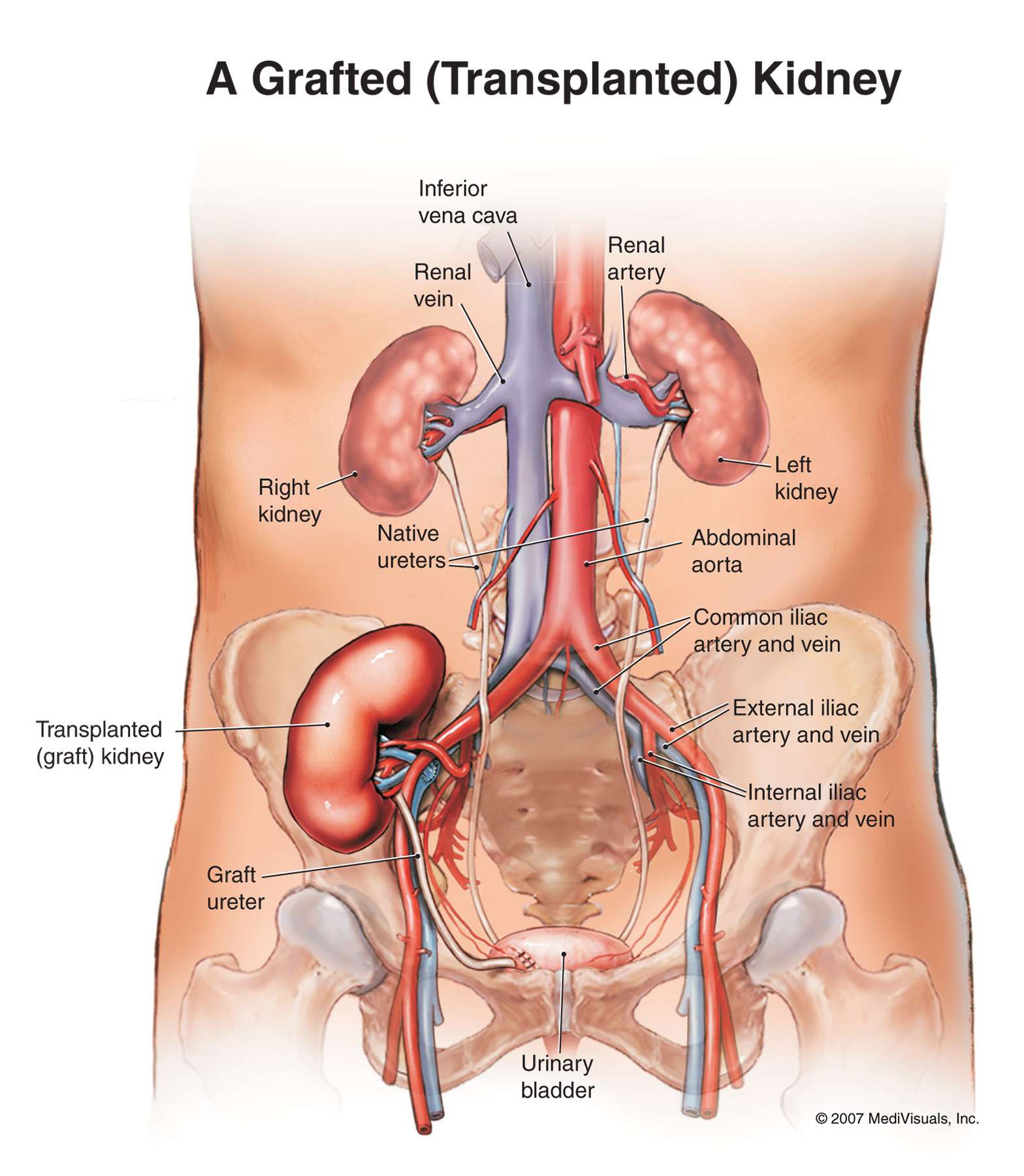 Kidneys and Urinary Tract. Causes, symptoms, treatment ...