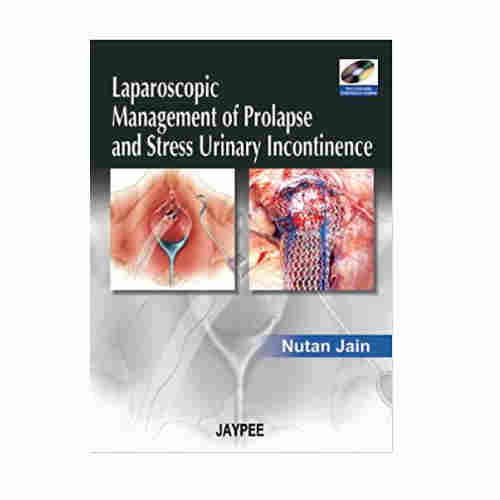 Laparoscopic Management of Prolapse and Stress Urinary incontinence ...