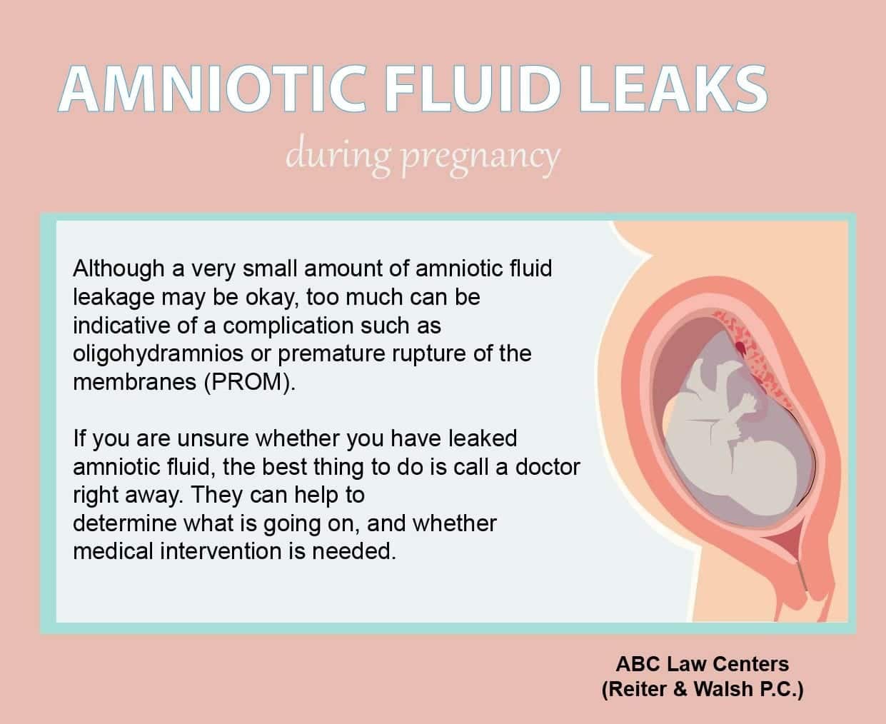 Leaking Amniotic Fluid, Oligohydramnios, and Birth Injury