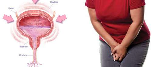 Learn about Overactive Bladder