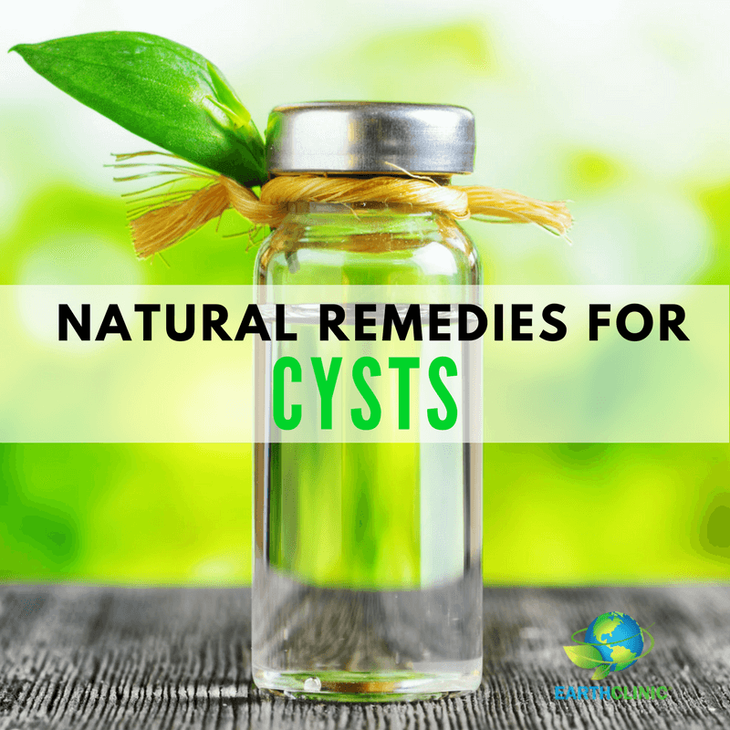 Natural Remedies for Cysts
