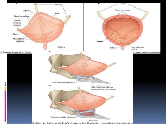 Neoplasm of bladder