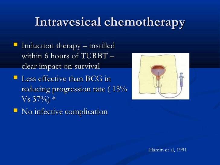 non surgical therapies of bladder cancer